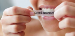 Dental-insurance